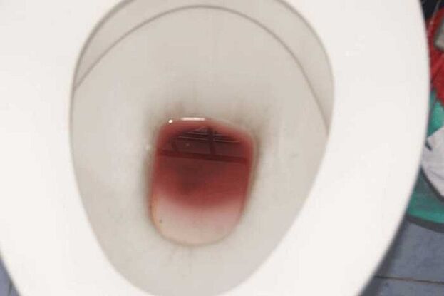 الرؤية عند الرجال عند الإثارة